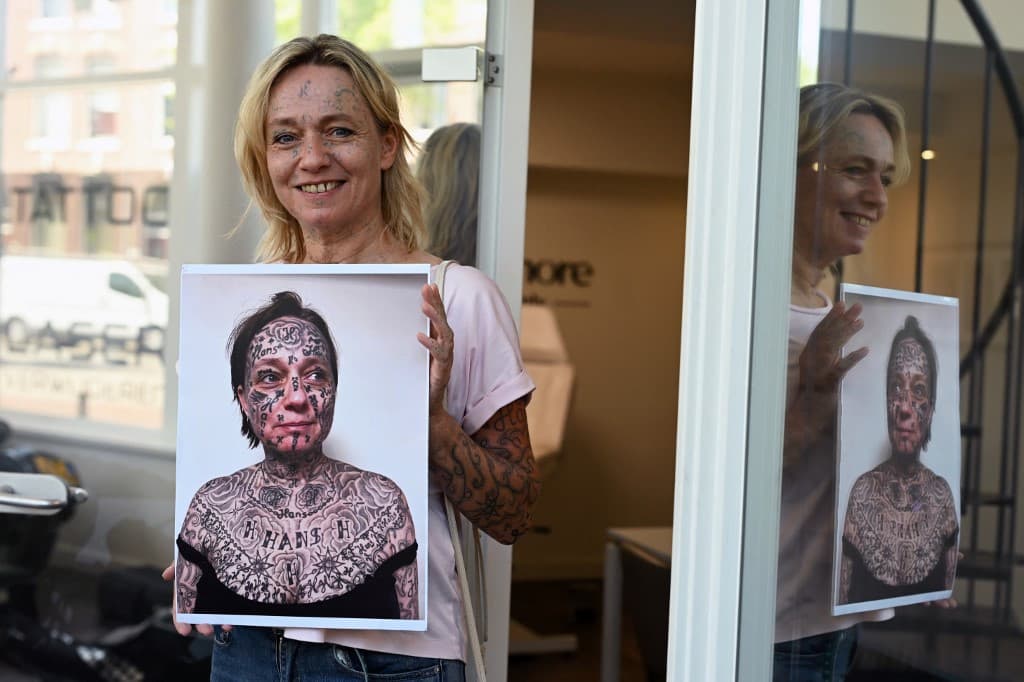 Violences conjugales: Tatouée 250 fois de force, elle se reconstruit grâce au laser